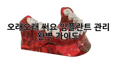 🦷✨ 오래오래 써요! 임플란트 관리 완벽 가이드